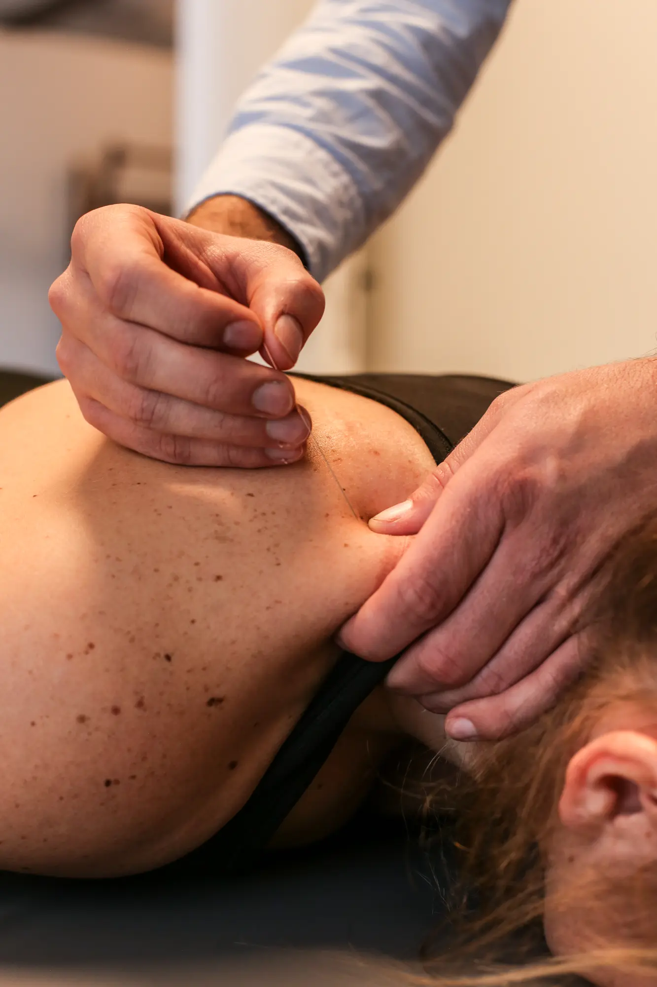 Myofasciale therapie (dry needling)